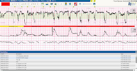 Trium CTG Online 3.0 screenshot
