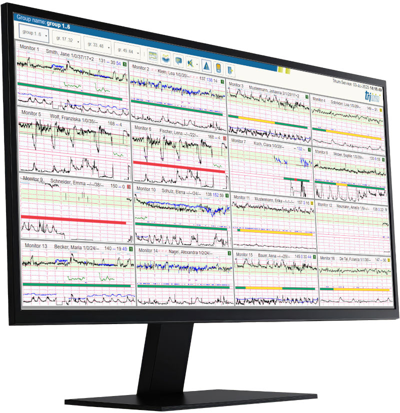 Trium CTG Online 3.0
